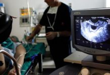 Experts Call for Egg Donor Registry