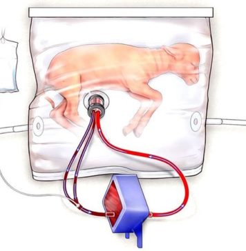 Fetal Lambs in ‘Biobags’ Show Promise for Artificial Human Wombs