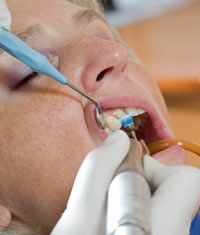 Is your teen too young for teeth whitening?