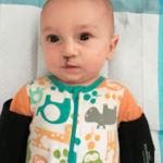 child-cleft-lip-palate-01gNsVizKAU9g_Dnd2-BZ.jpg