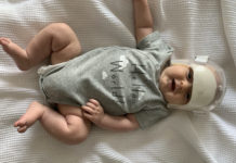 My Son Was Born With Craniosynostosis—Here’s What Parents Need to Know About the Birth Defect of the Skull