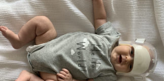 My Son Was Born With Craniosynostosis—Here’s What Parents Need to Know About the Birth Defect of the Skull