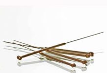 Did Acupuncture for Fertility Really Help Me Get Pregnant?